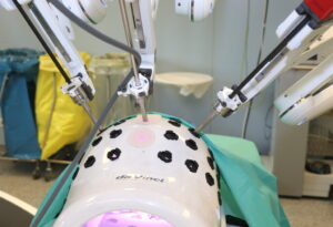 Im Solinger Klinikum ist seit diesem Frühjahr ein "DaVinci"-OP-Robotersystem im Einsatz. (Foto: © Bastian Glumm)