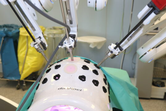 Im Solinger Klinikum ist seit Mai 2022 ein "DaVinci"-OP-Robotersystem im Einsatz. (Foto: © Bastian Glumm)