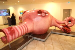Das begehbare Gebärmutter-Modell war das zentrale Element des 1. Solinger Tages für Frauengesundheit im Hofgarten und bot Besucherinnen und Besuchern einen anschaulichen Einblick in Anatomie und mögliche Erkrankungen der weiblichen Organe. (Foto: © Bastian Glumm)