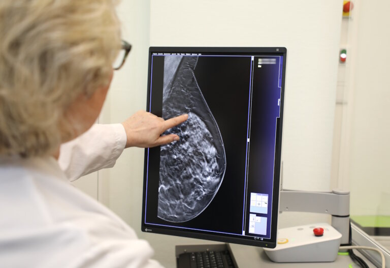Solingen Klinikum nimmt neues MammographieGerät in Betrieb Das SolingenMagazin